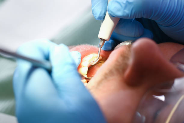 Best Emergency Denture Repair in Zephyrhills West, FL