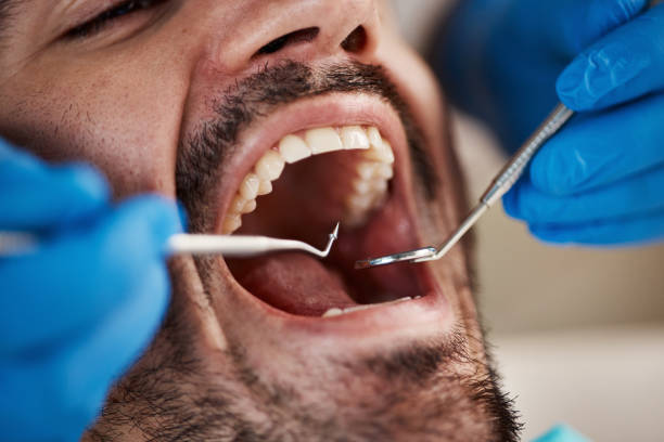 Best Emergency TMJ Treatment in Zephyrhills West, FL