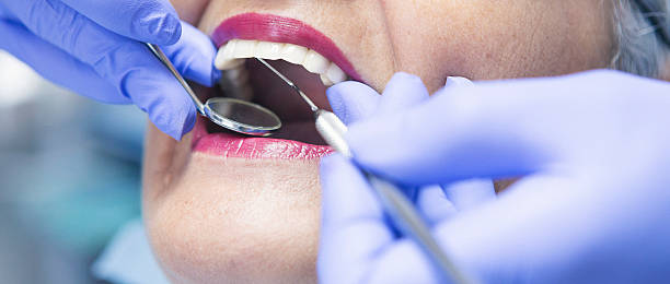 Best Emergency Tooth Extraction in Zephyrhills West, FL